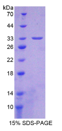 乳腺癌易感蛋白1(BRCA1)重组蛋白