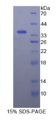 热休克转录因子1(HSF1)重组蛋白
