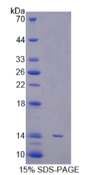 信号传导转录激活因子5A(STAT5A)重组蛋白