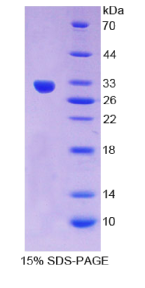 葡萄糖激酶调节蛋白(GKRP)重组蛋白