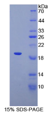 肾上腺素能受体α1A(ADRα1A)重组蛋白