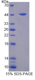 水通道蛋白4(AQP4)重组蛋白