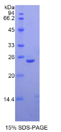 血小板反应蛋白(THBS1)重组蛋白