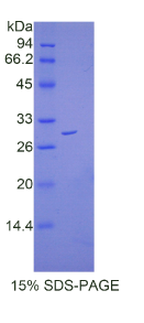 连环蛋白β1(CTNNβ1)重组蛋白