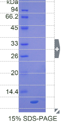 巨噬细胞炎性蛋白3α(MIP3α)重组蛋白