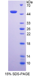 嗜中性粒细胞胞浆因子1(NCF1)重组蛋白