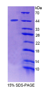 信号转导衔接分子2(STAM2)重组蛋白