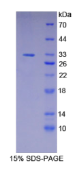 信号传导转录激活因子2(STAT2)重组蛋白