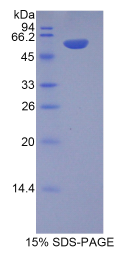 嗜铬蛋白B(CHGB)重组蛋白