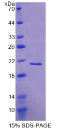 视锥蛋白样蛋白1(VSNL1)重组蛋白