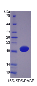 血红蛋白α1(HBα1)重组蛋白