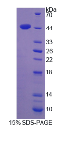 平滑肌肌动蛋白γ2(ACTγ2)重组蛋白