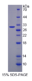 乳腺癌抗雌激素药物耐药性基因1(BCAR1)重组蛋白