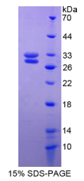 热休克转录因子2(HSF2)重组蛋白