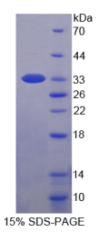 肌球蛋白轻链激酶2(MYLK2)重组蛋白