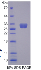 甲基CpG结合蛋白2(MECP2)重组蛋白