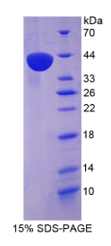 巨噬细胞炎性蛋白1α(MIP1α)重组蛋白