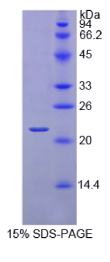 视黄醇结合蛋白4(RBP4)重组蛋白