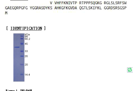 髓鞘碱性蛋白(MBP)重组蛋白