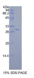 信号传导转录激活因子6(STAT6)重组蛋白