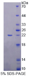 心肌细胞特异性增强因子2A(MEF2A)重组蛋白