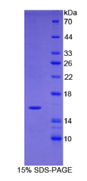 类胰蛋白酶δ1(TPSδ1)重组蛋白