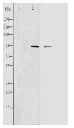 CLIC6 Antibody