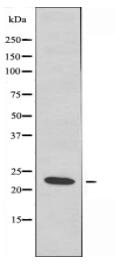 DIRA1 Antibody