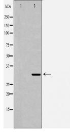 CD74 Antibody