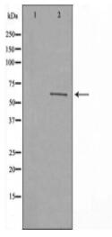 Cytochrome P450 2C8/9/18/19 Antibody