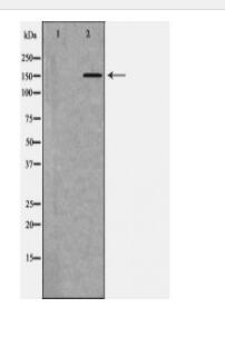 ATP7B Antibody