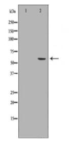 BMPR1A Antibody