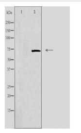 AKAP10 Antibody