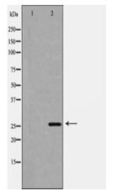 BCL10 Antibody