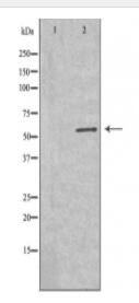 GK Antibody