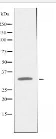CA14 Antibody