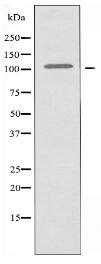 CBCP2 Antibody