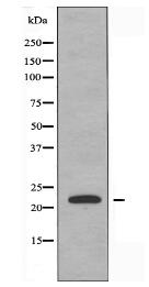 CBF β Antibody