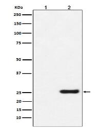 GST-Tag Mouse Monoclonal Antibody