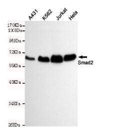 Smad2 Mouse mAb