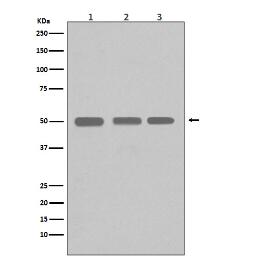 beta I Tubulin Antibody