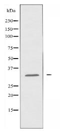 CBR3 Antibody