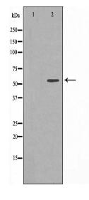 CCT8 Antibody