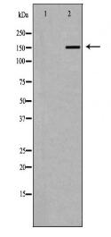 A2M Antibody