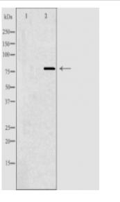 BARD1 Antibody