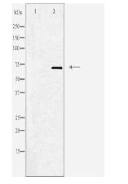Adrenergic Receptor α-2C Antibody