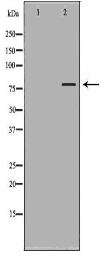 ABCG8 Antibody