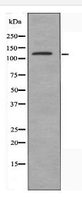 ADCY5/6 Antibody