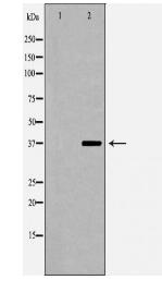 CFHR1 Antibody