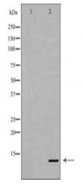 HMGA2 Antibody